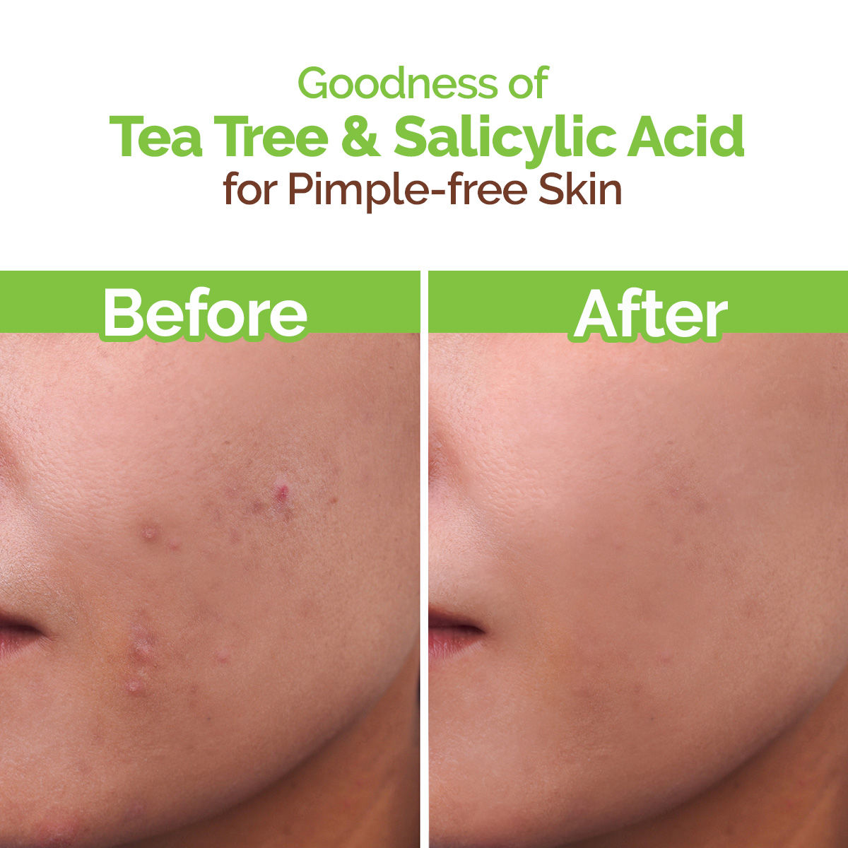 Face Wash With Tea Tree Oil And Neem Extract For Acne &pimples
