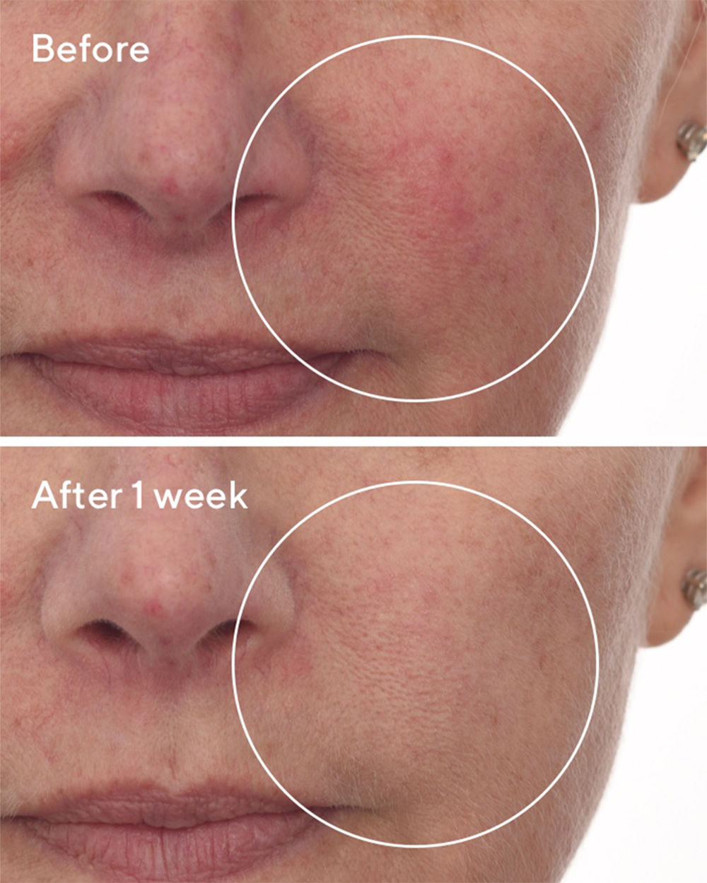 Cellular Hydration Repair Serum