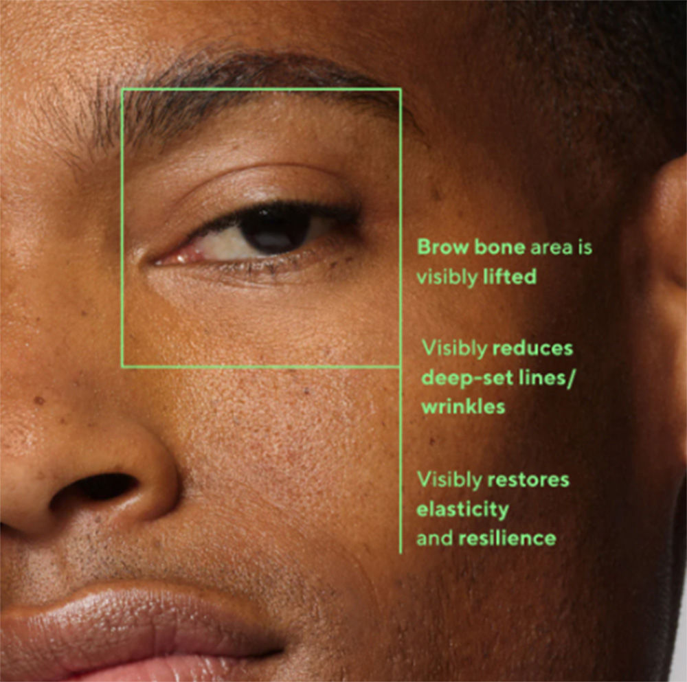 Retinal Resculpt Eye Treatment