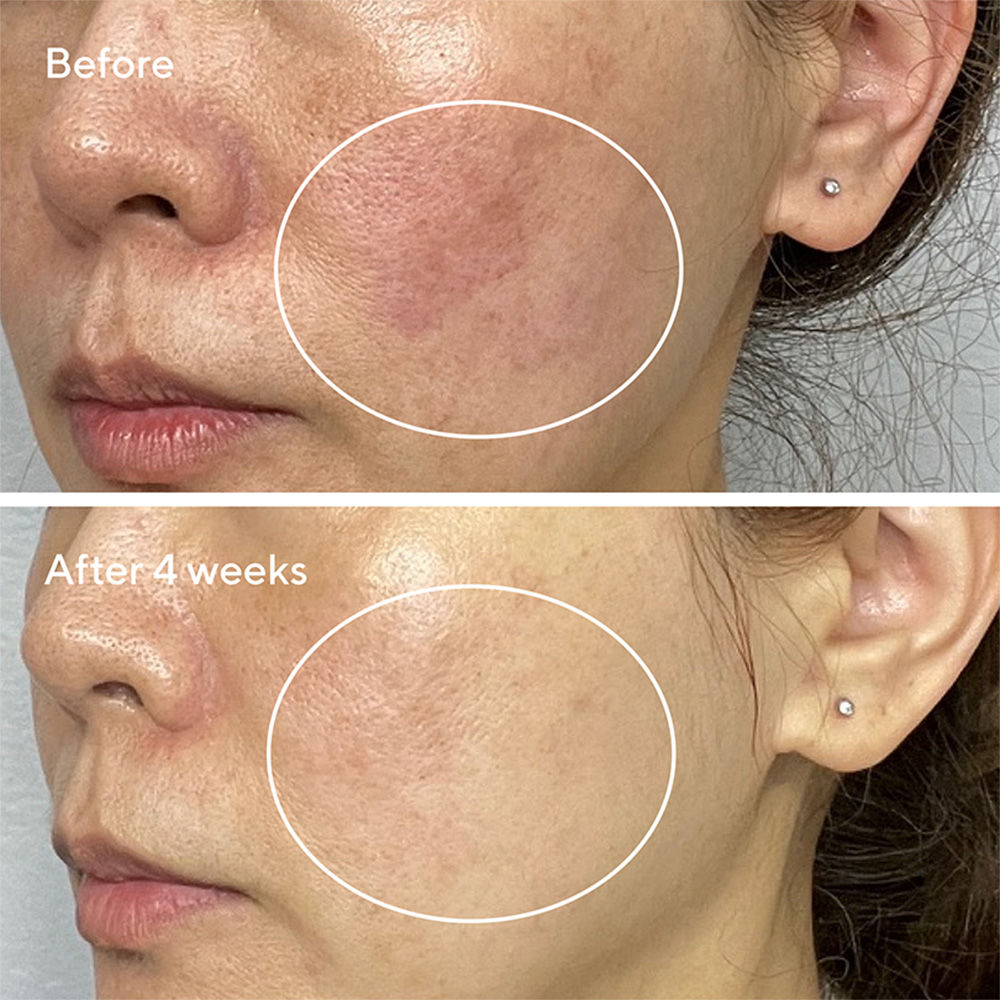 Sensitive Skin Heartleaf Gentle Resurfacing Serum