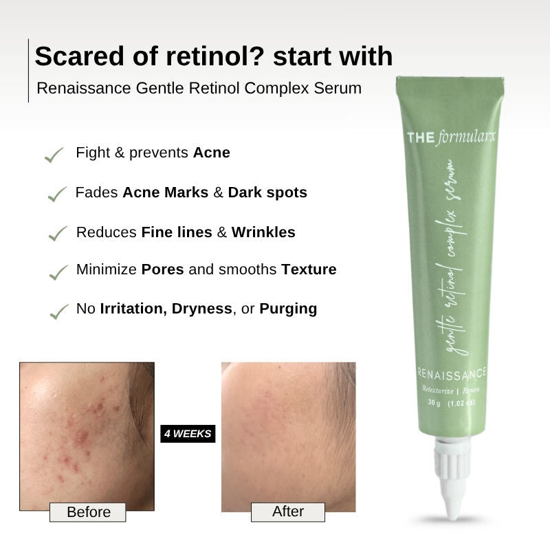 Gentle Retinol Night Serum For Acne, Dark Spots, Enlarged Pores & Anti-Aging Care