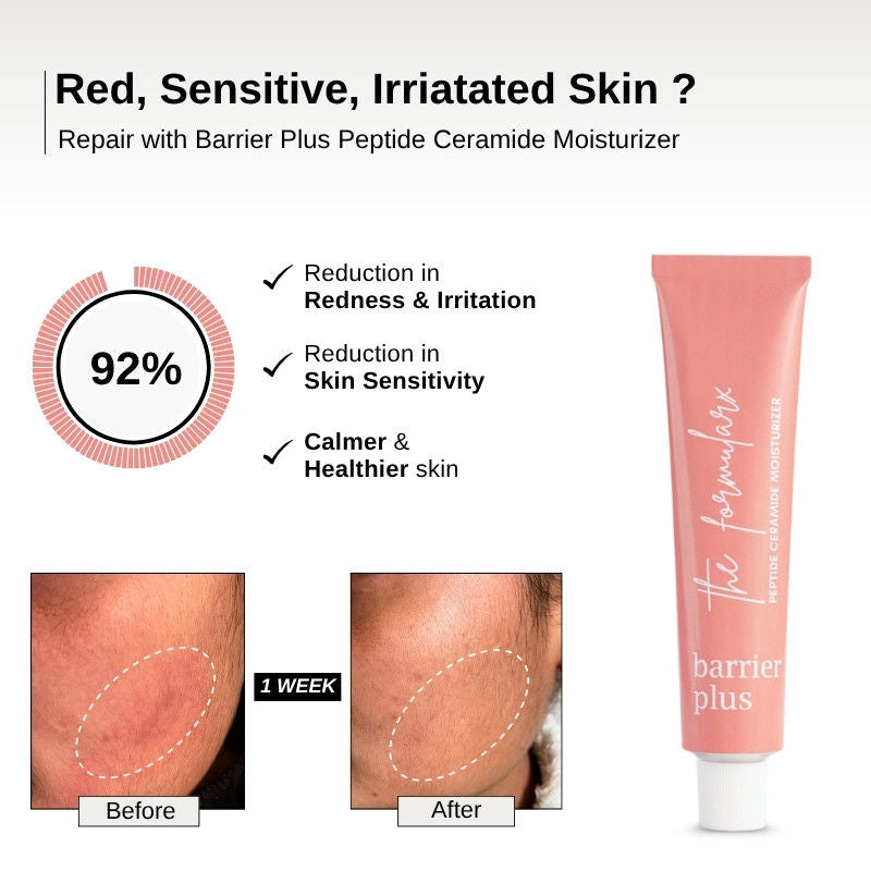 Barrier Plus Peptide Ceramide Moisturizer For Dry, Normal, & Sensitive Skin