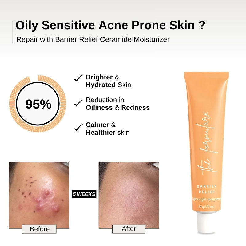 Barrier Relief Lightweight Ceramide Moisturizer For Oily, Acne-Prone, Sensitive Skin