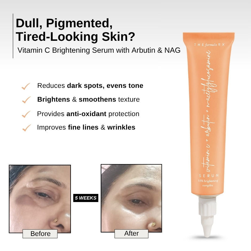 Vitamin C Brightening Face Serum With Arbutin For Glow, & Dark Spots Removal