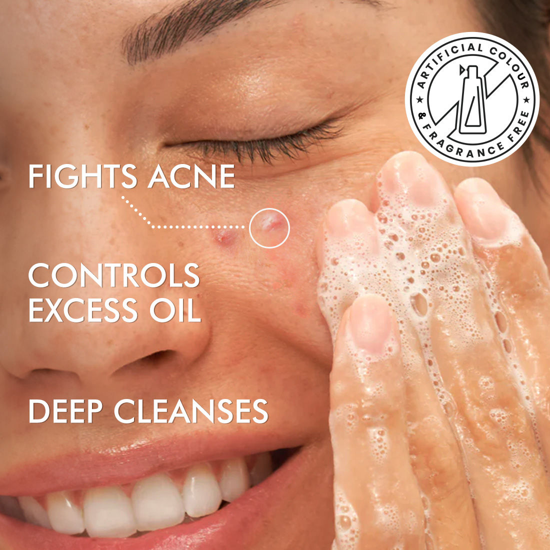 2% Salicylic Acid Anti Acne Face Wash With Niacinamide & Matcha Tea, For Oil Control