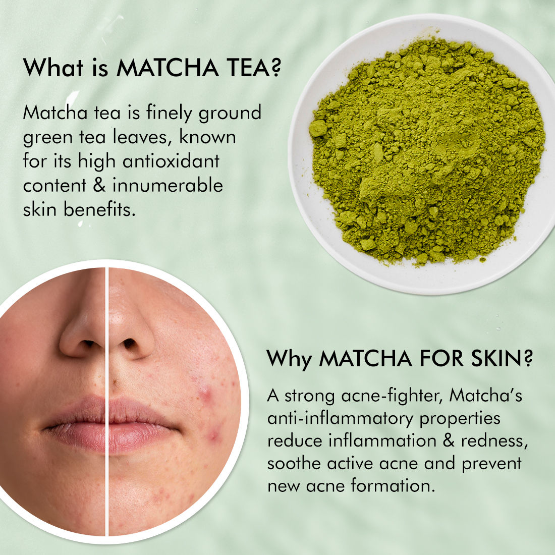 2% Salicylic Acid Anti Acne Face Wash With Niacinamide & Matcha Tea, For Oil Control