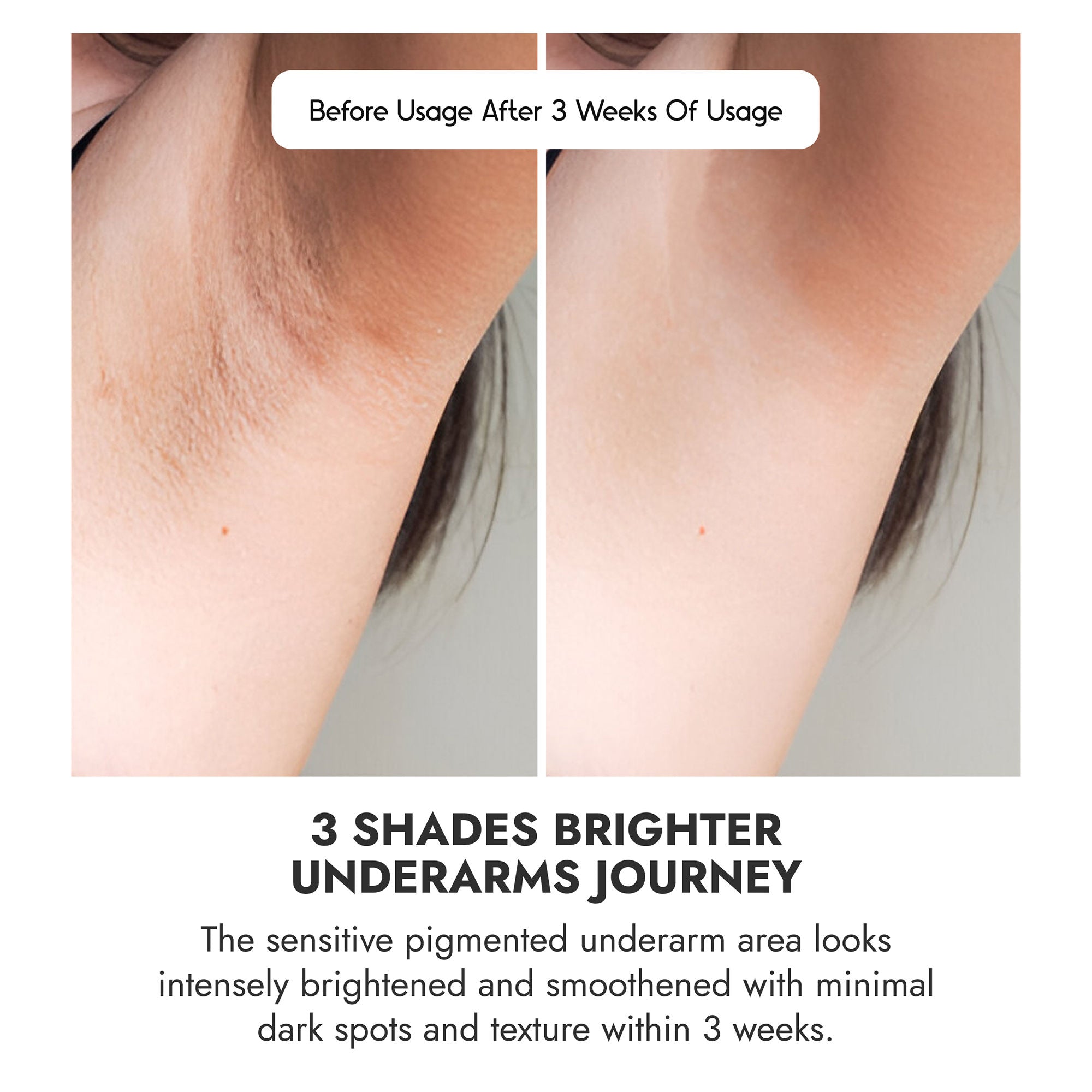 Brightening Underarm Roll On Serum For Women