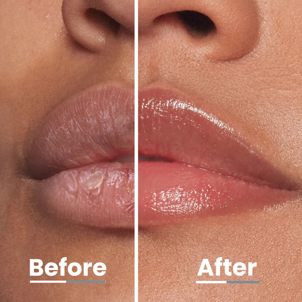Vitamin Infused Peptide Lip Balm - Peach For Dry & Chapped Lip, Hydrates & Moisturizes