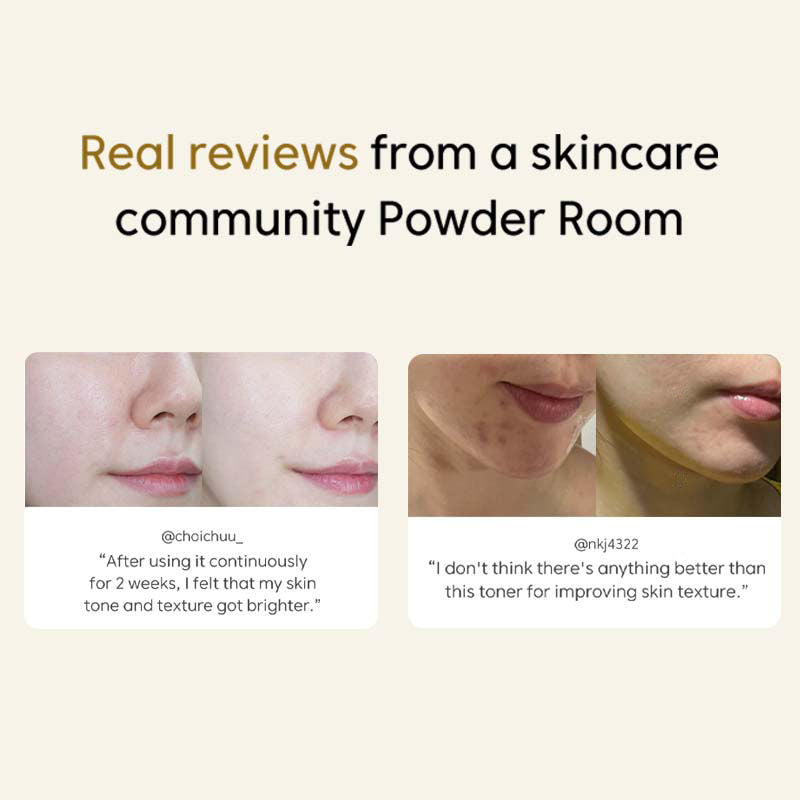 Rice Korean Niacinamide Toner- Brightening & Pigmentation, Dermatologically Tested