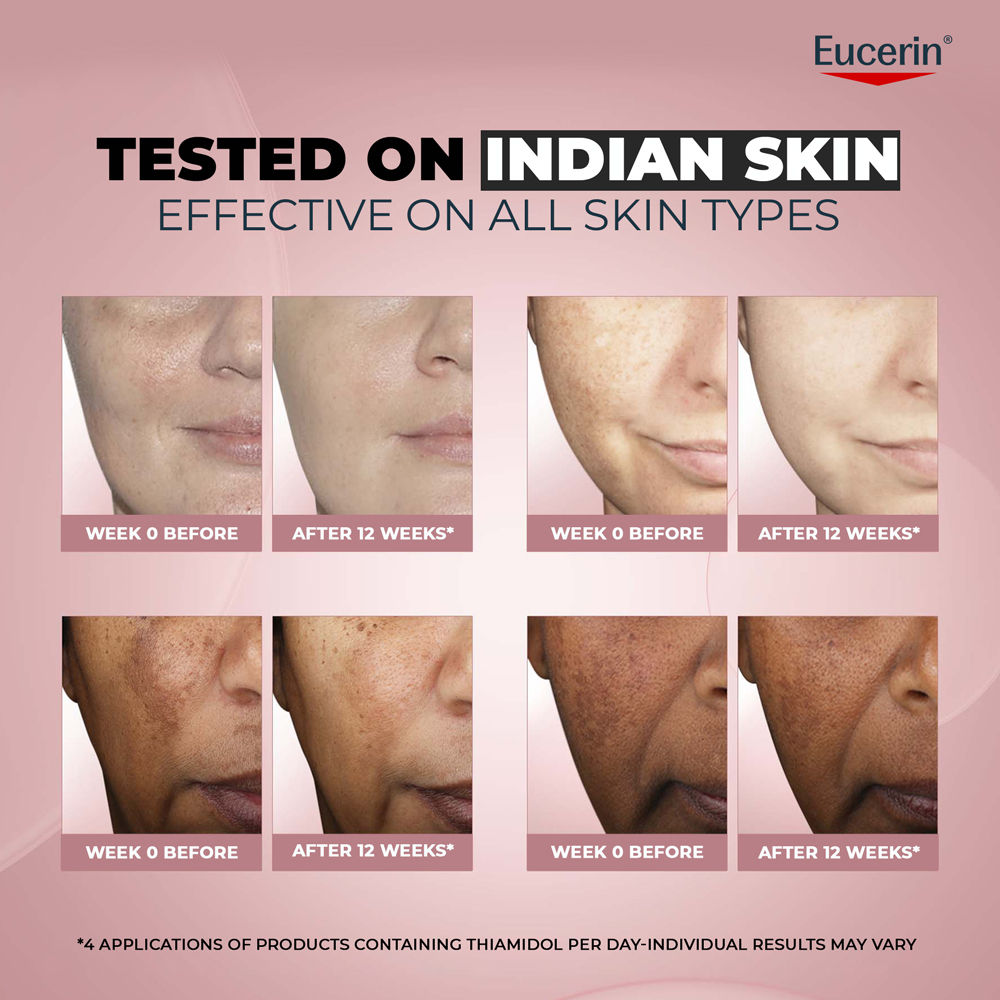Anti-Pigment Day Cream With Sunscreen SPF30 & Thiamidol Reduces And Prevents Dark Spots