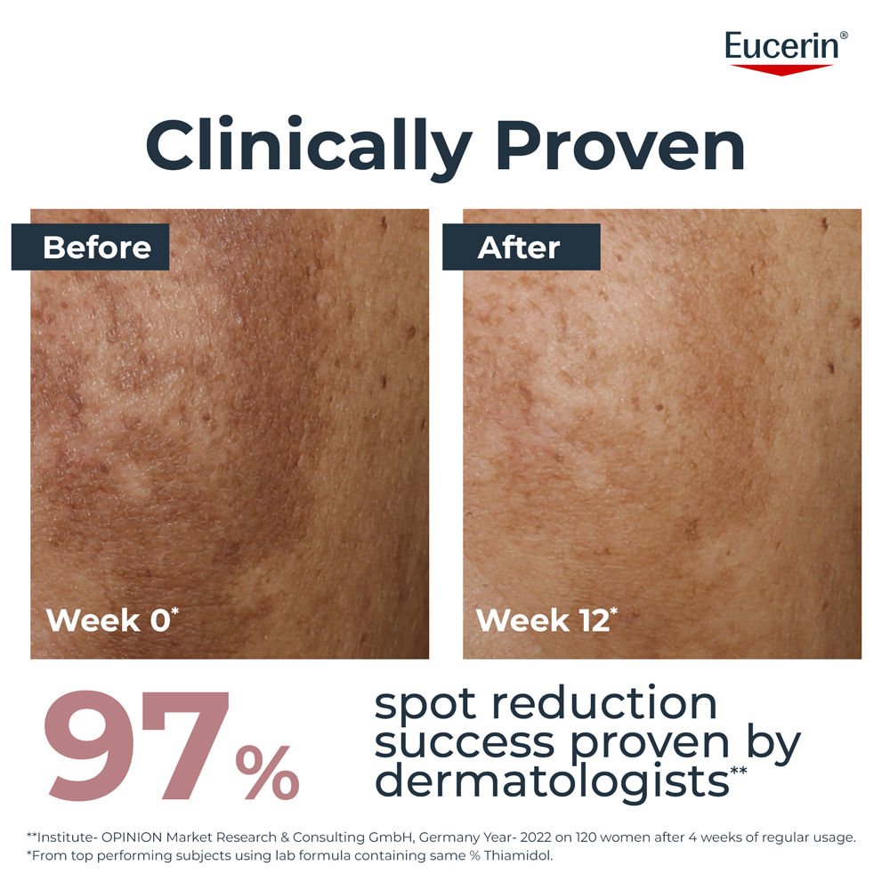 Anti-Pigment Dual Serum With Thiamidol & Hyaluronic Acid , Reduces Dark Spots & Rejuvenates