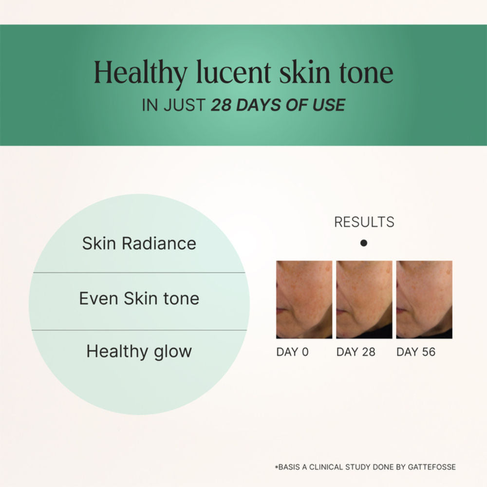 Sun Kissed Sun Care Gel With Aloe Vera Soothes Sun Damaged Skin, Suited For All Skin Types