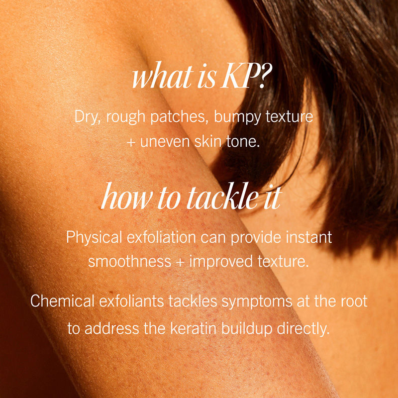 Kp Bump Eraser Body Scrub With 10% Aha