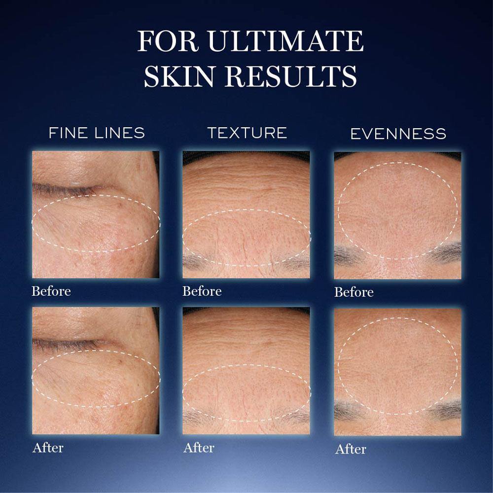 Genifique Ultimate Skin Repair Serum With Beta Glucan Suited for Indian Skin