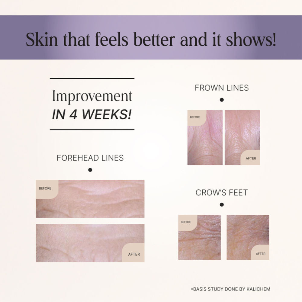 Lightweight Face Serum 1.5% Hyaluronic Acid Anti Aging Wrinkle Lift And Botox Like Effect