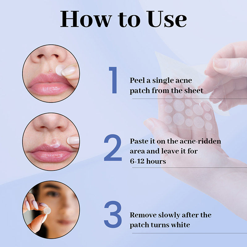 Erazer Acne Pimple Patches - 0.5% Salicylic Acid, Waterproof & Transparent, 36 Patches