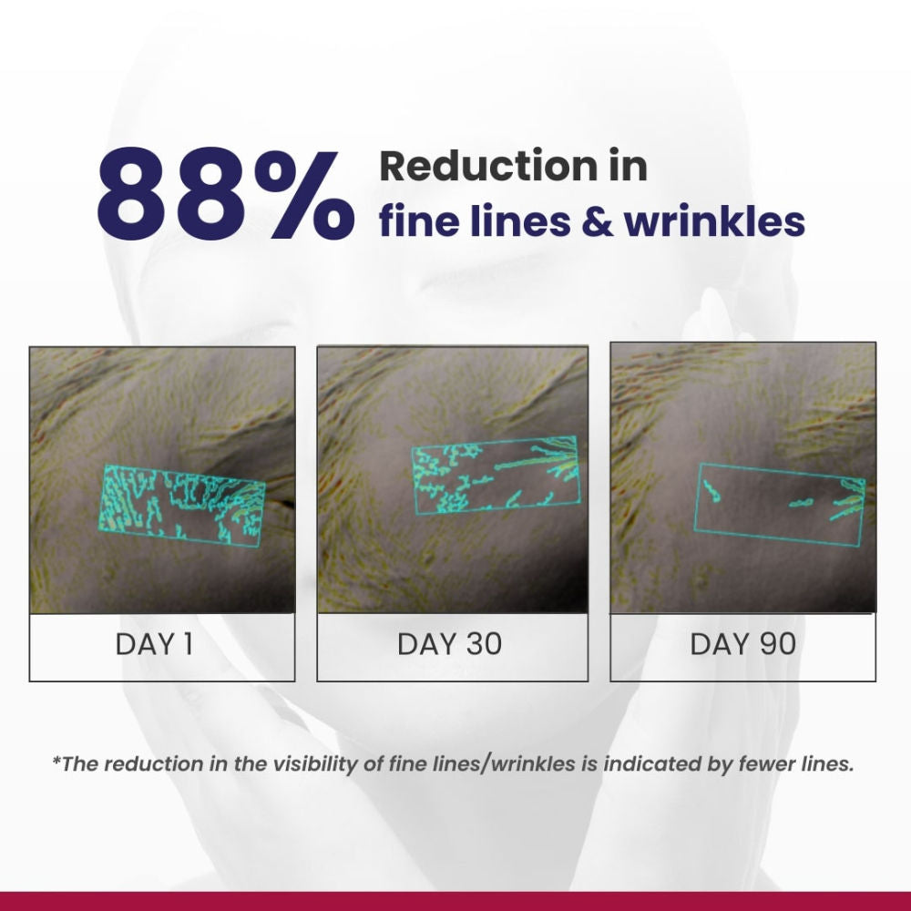 0.1% Retinol Night Creamtreat For Wrinkles & Skin Tightening