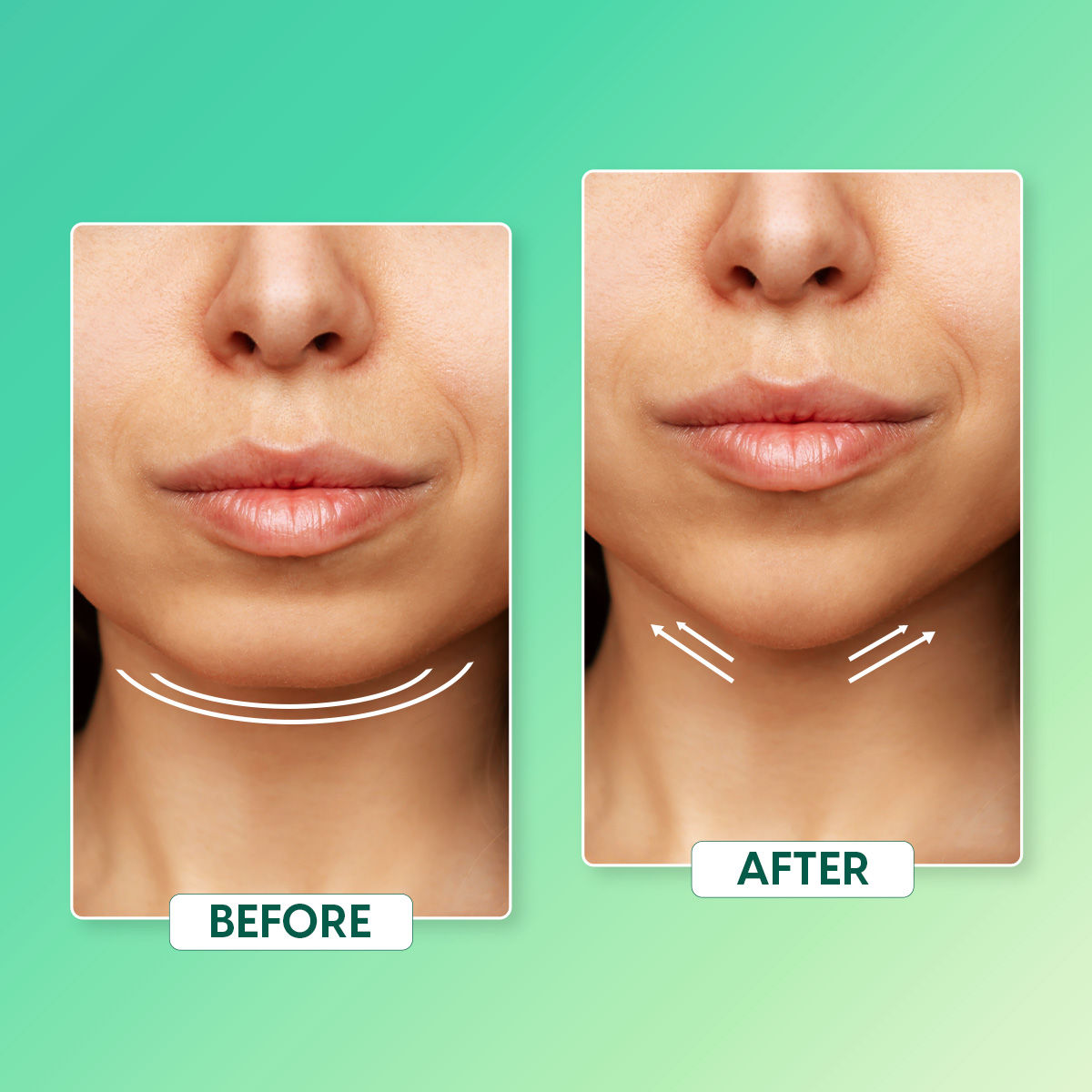 V Line Face Lifting Mask Double Chin Reducer Belt for Anti Aging Facial Toning, Slimming