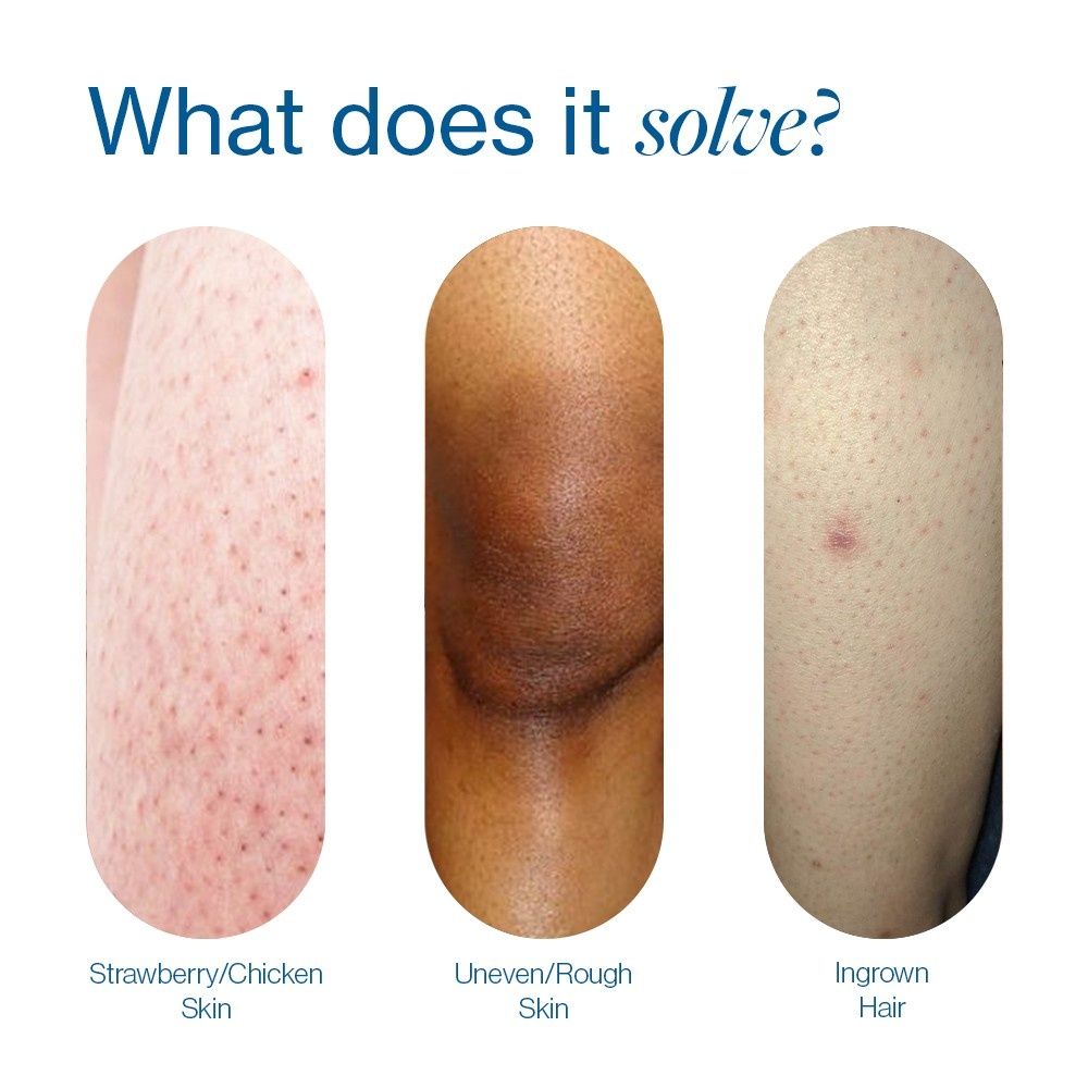 7% Glycolic Acid Stick Body Exfoliation For Smooth, Clear & Even Skin