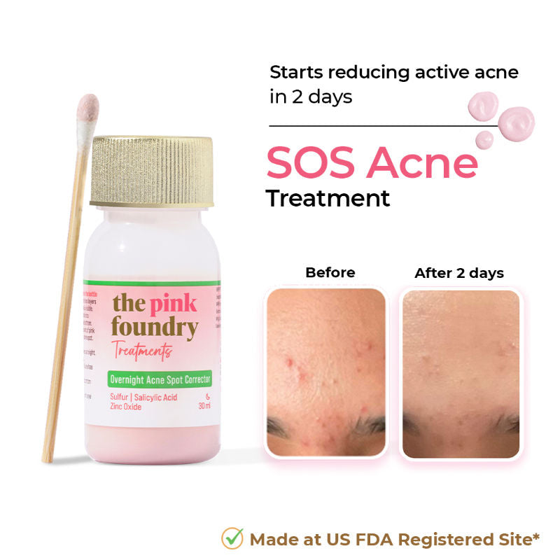Overnight Acne Spot Corrector - 30ml