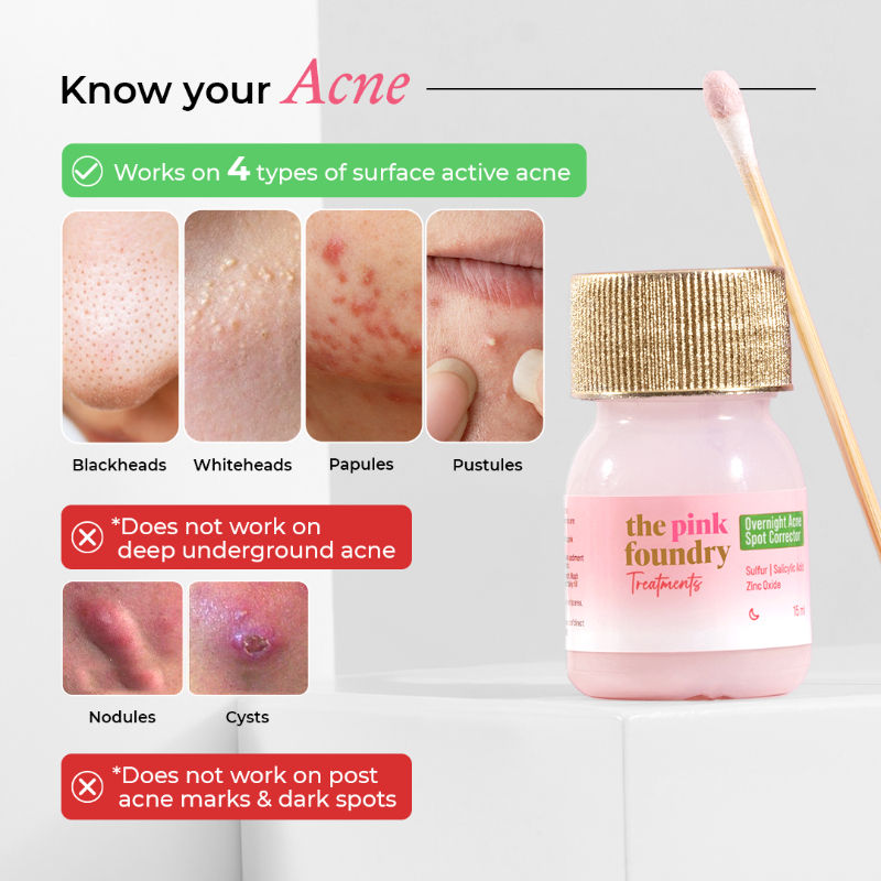 Overnight Acne Spot Corrector