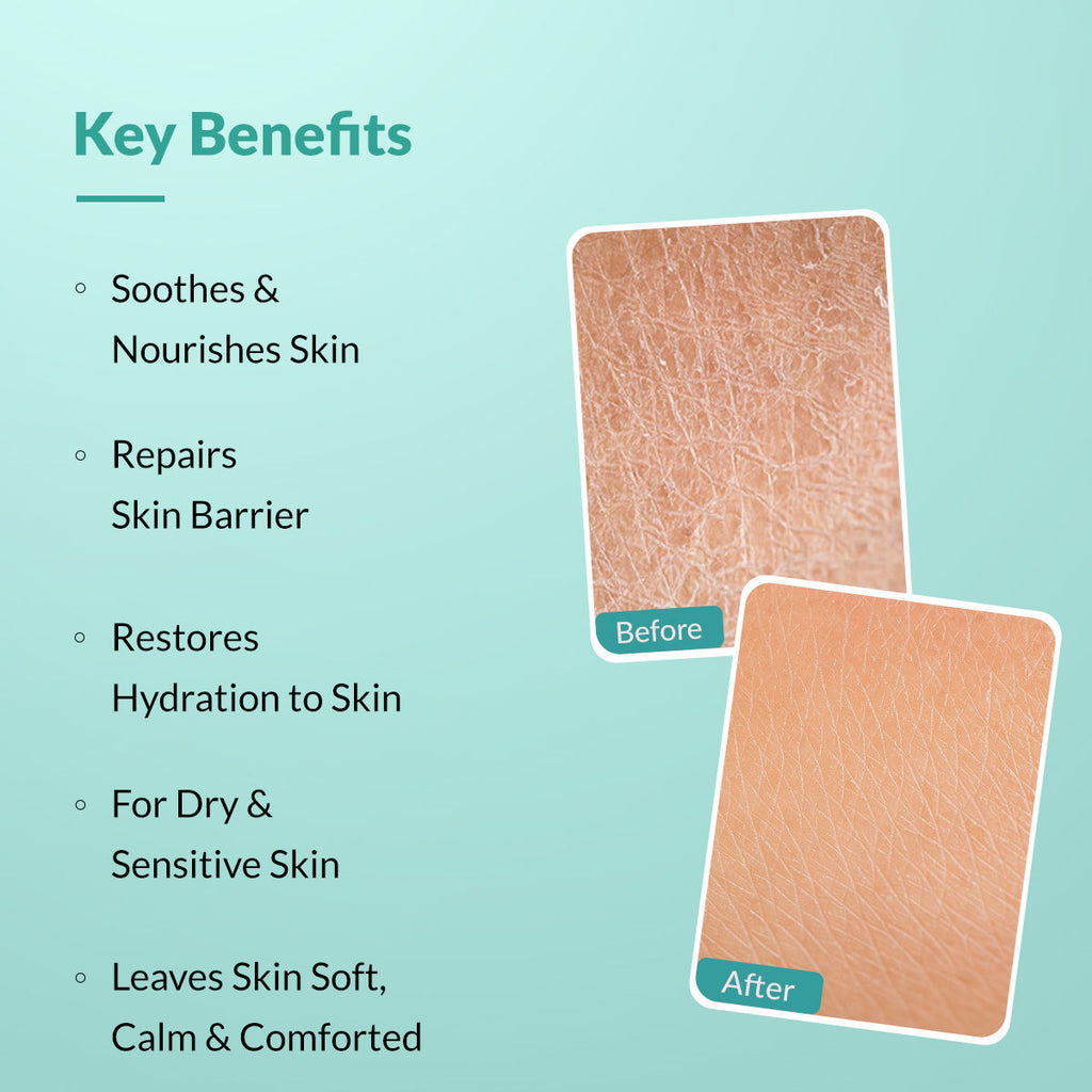 Dewrav Body Lotion For Dry & Sensitive Skin With Shea Butter & Ceramides Complex