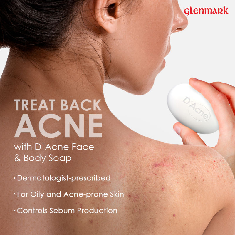 Body & Face Soap for Acne-Prone and Oily Skin, Visible Acne Reduction in 10 Days