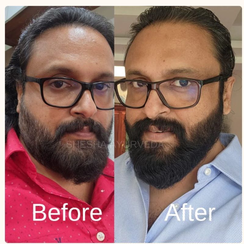 Beard Color For Men - Natural Black
