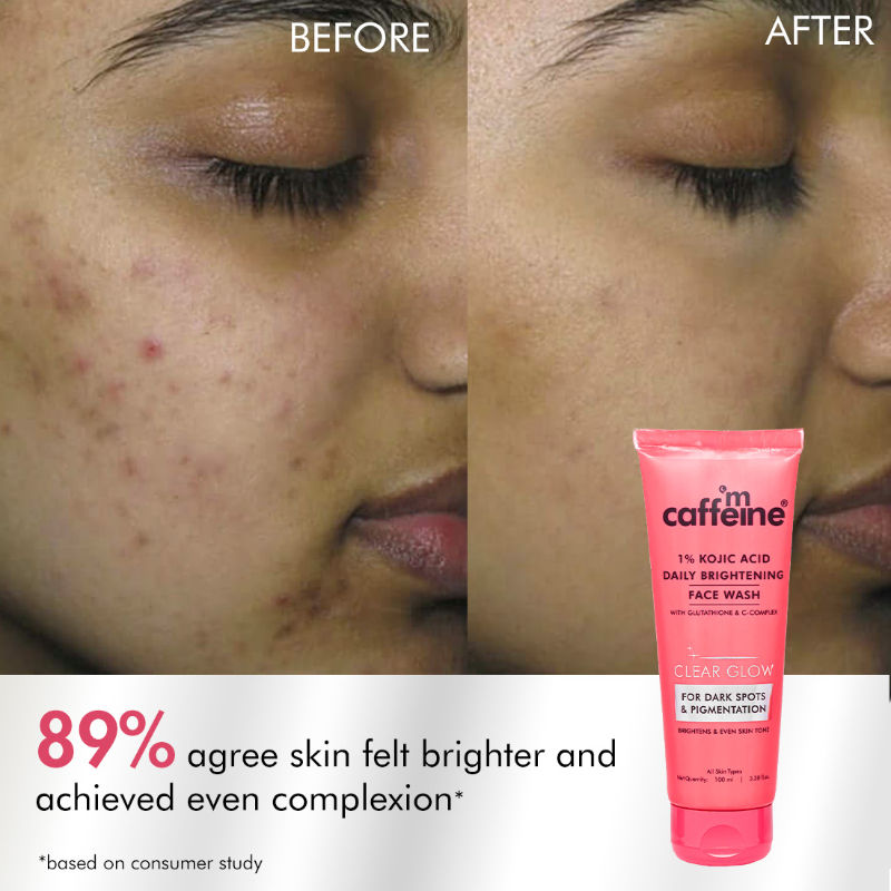 CLEAR GLOW 1% Kojic Acid Daily Brightening Face Wash