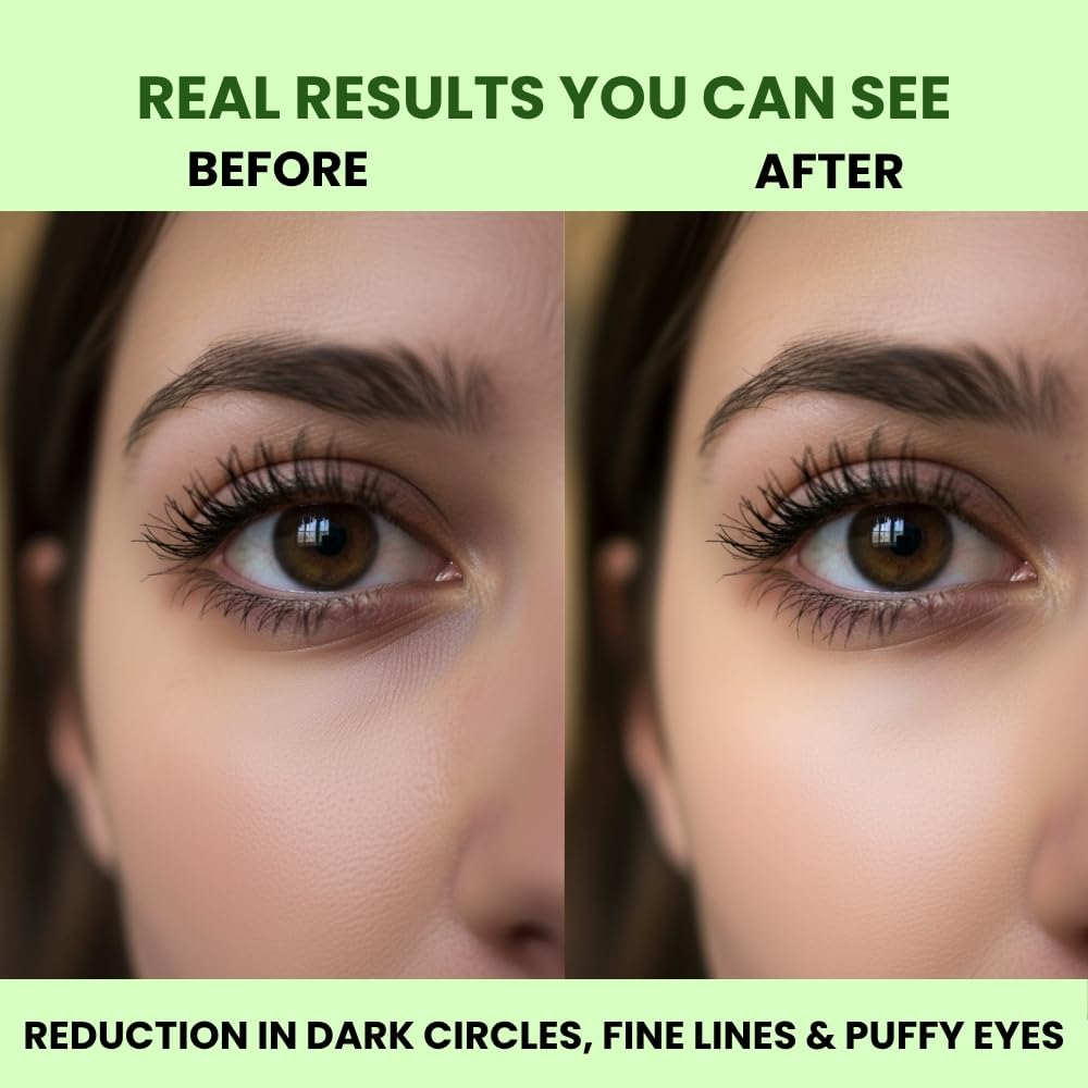 Under Eye Patches, Reduces Dark Circles, Puffiness & Fine Lines
