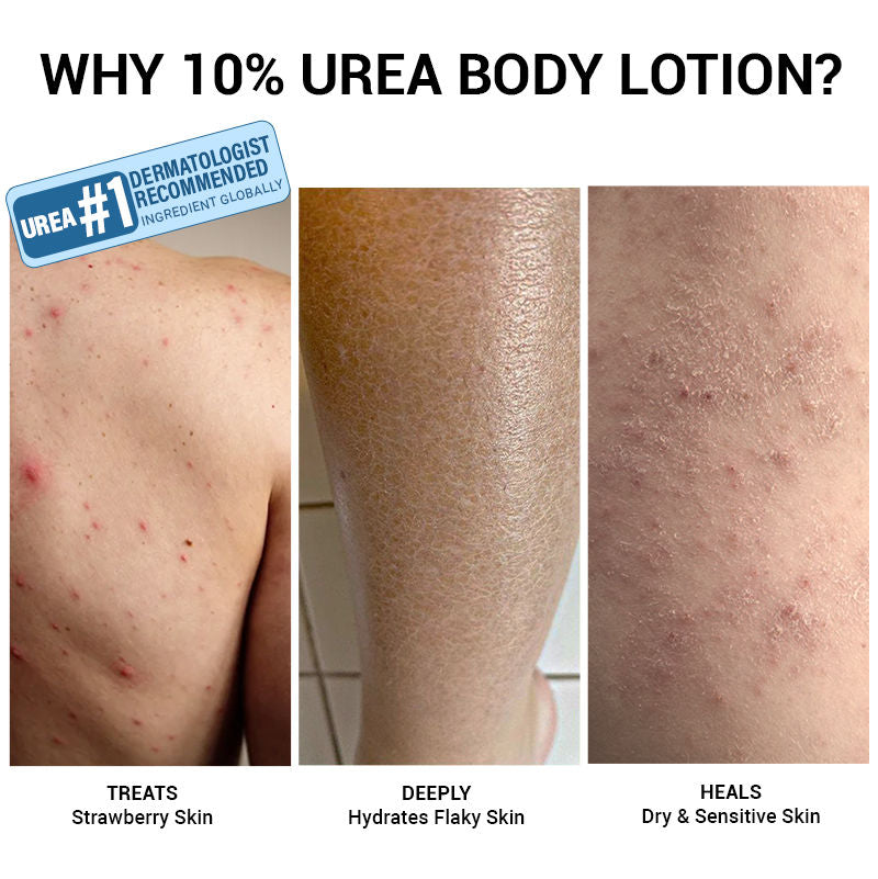 10% Urea & Avocado Oil Body Lotion