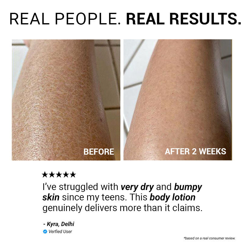 10% Urea & Avocado Oil Body Lotion