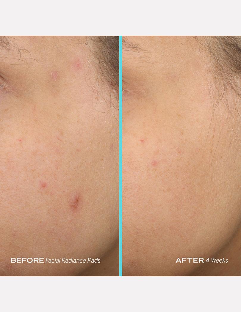 Facial Radiance Pads Compostable