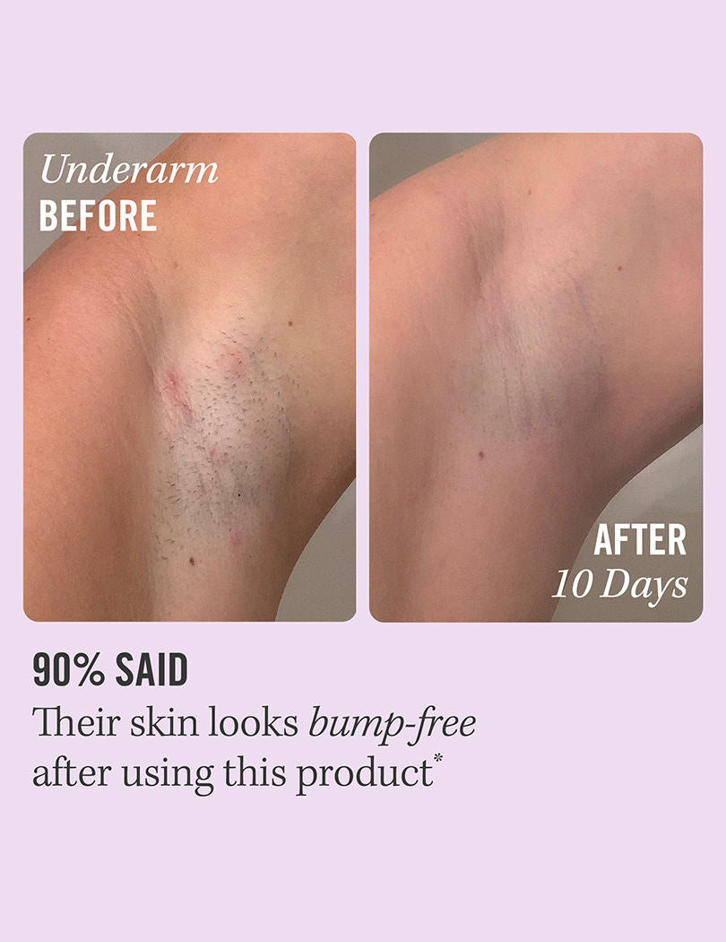 Ingrown Hair Treatment Pads