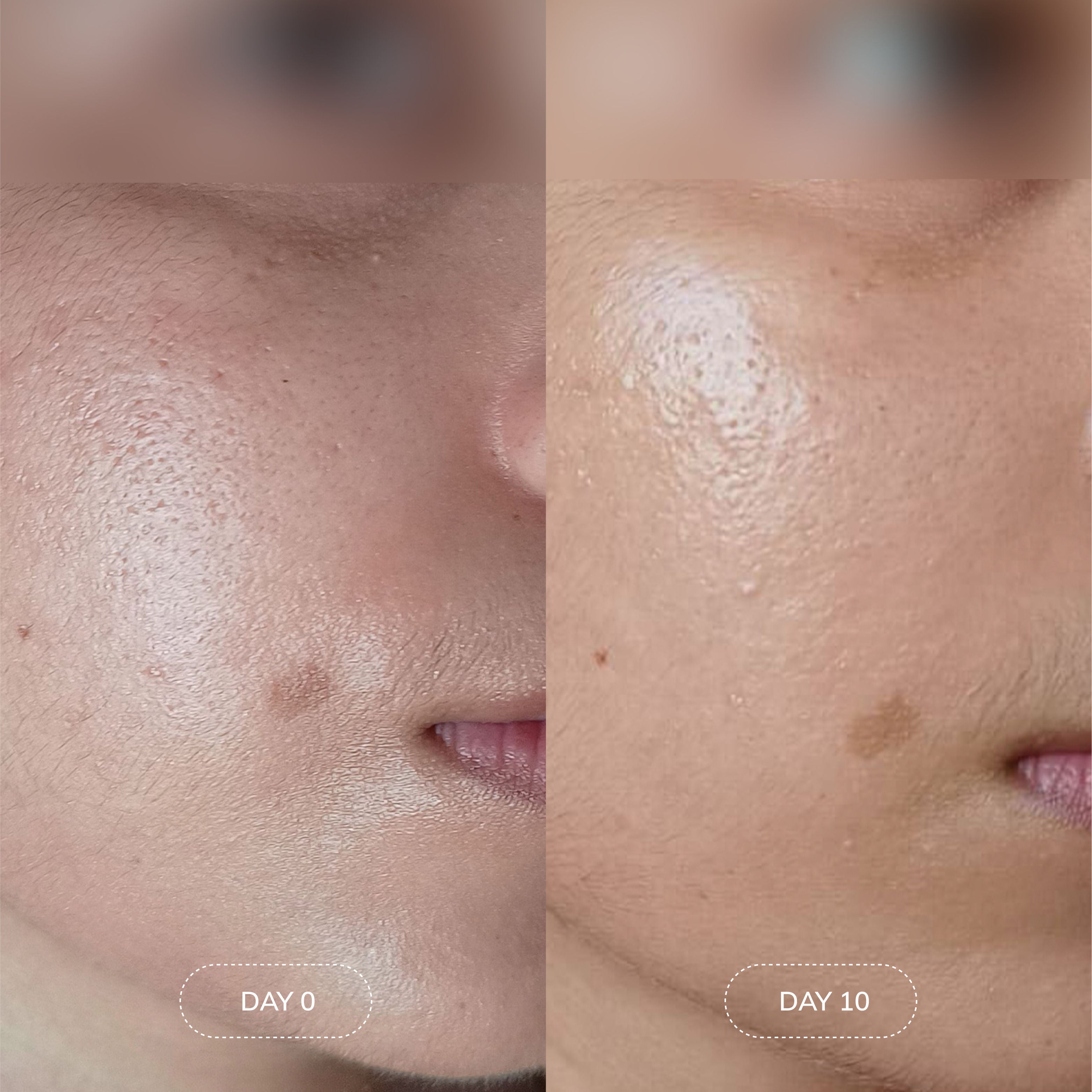 Hydra-Milk Toner