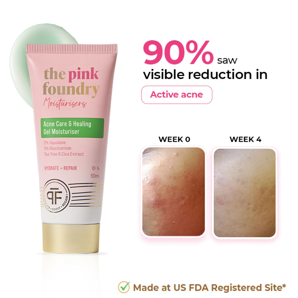 Acne Moisturiser 2% Squalane & 3% Niacinamide Oil Free Hydration & Acne Prevention