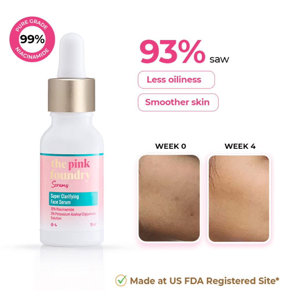 12% Niacinamide Serum - Evens Skin Texture, Controls Excess Oil & Refines Pores - 15ml