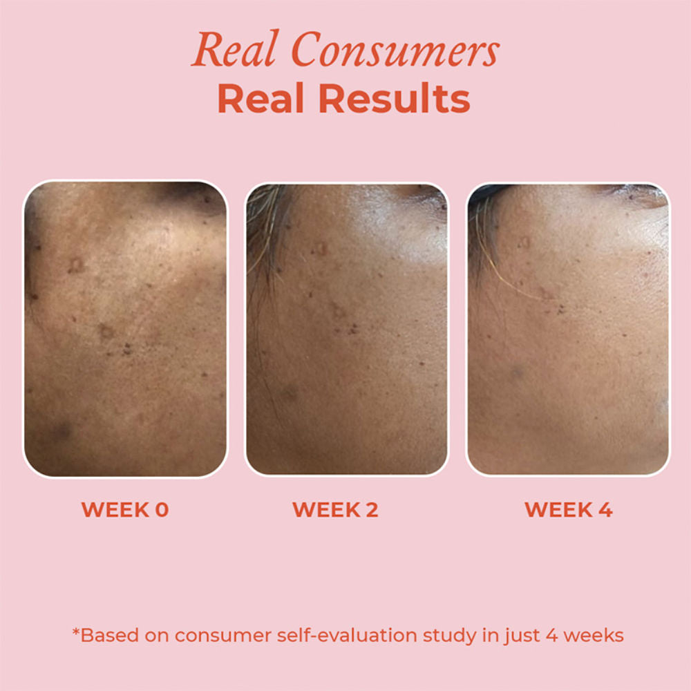 15% Vitamin C Brightening Serum