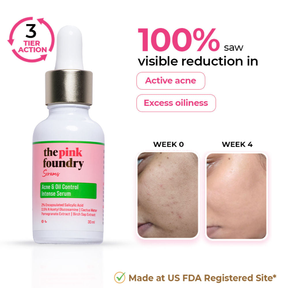 Acne & Oil Control Intense Face Serum with 2% Salicylic Acid