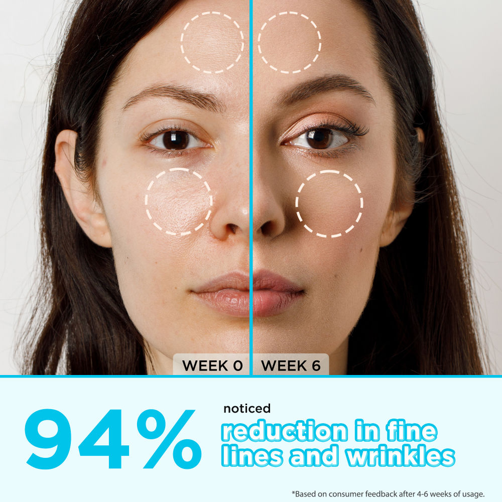 Retinol Anti-Aging Face Serum - Reduces Fine Lines, Boosts Collagen, Hydrates & Skin Firming