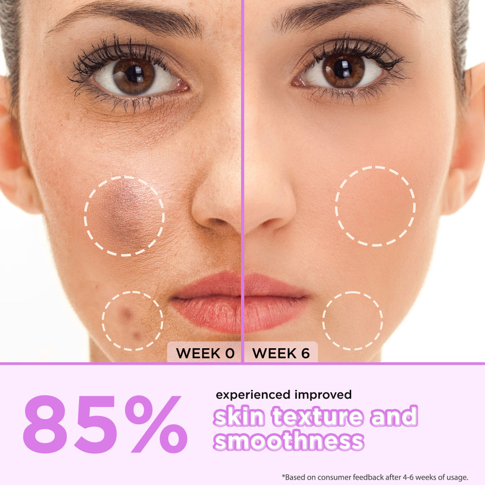 10% Glycolic Acid, 2% Kojic Acid Dark Spot Serum- Brightens Skin & Reduces Hyperpigmentation