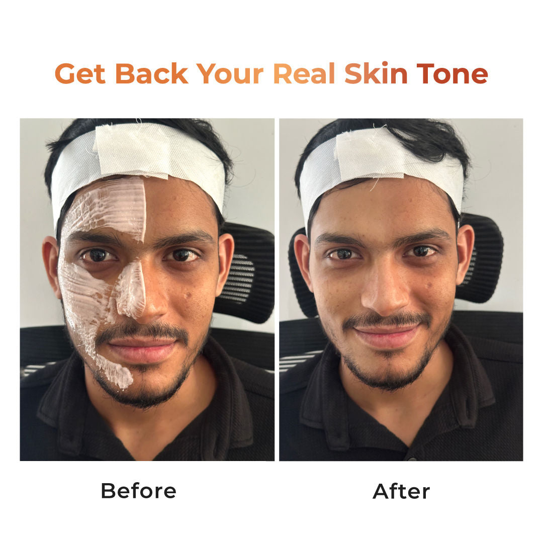 Tan Vanish Gluta-Kojic Skin Polish