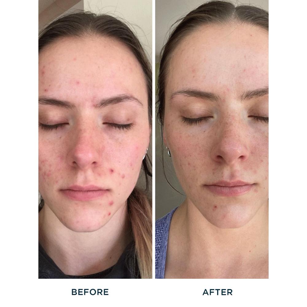 Purify Me Hydrating Facial Cleanser