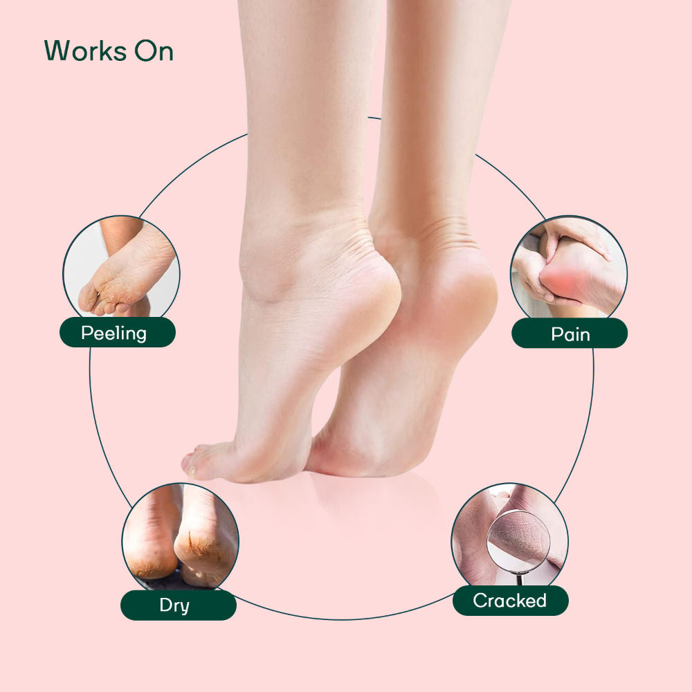 Silicone Gel Heel Socks For Dry Hard Cracked Heel Repair Pad - Pink, Blue & Grey