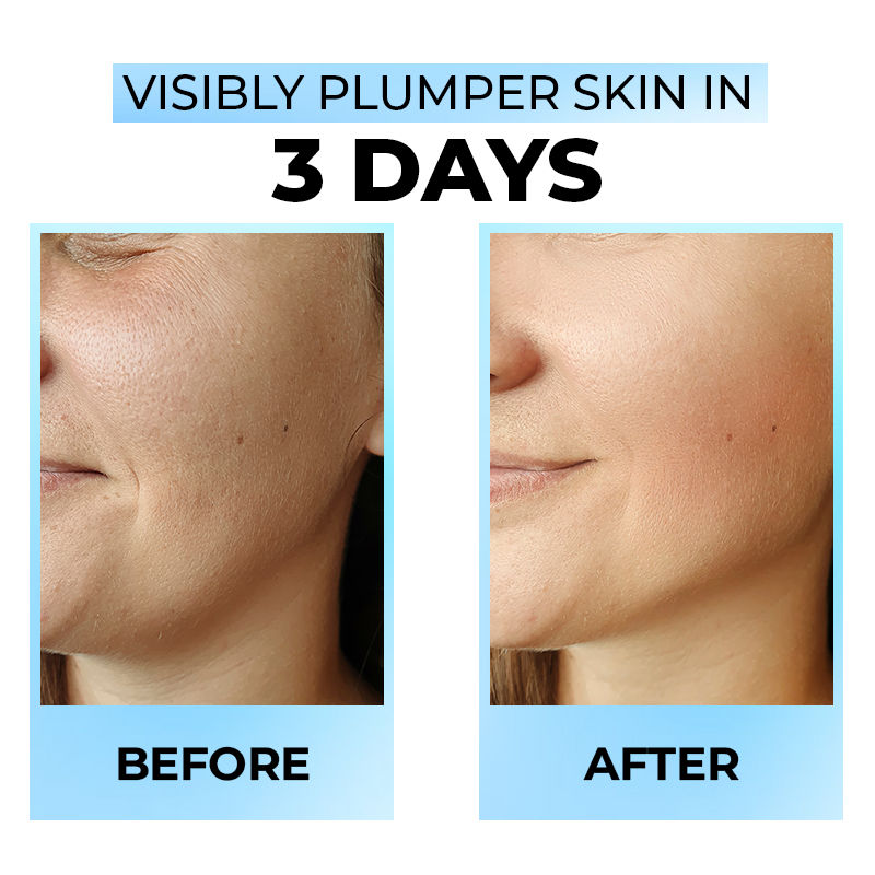 Hydrate & Shine Face Serum With 11% Hyaluronic Acid Complex For Brightening, 48 Hr Hydration