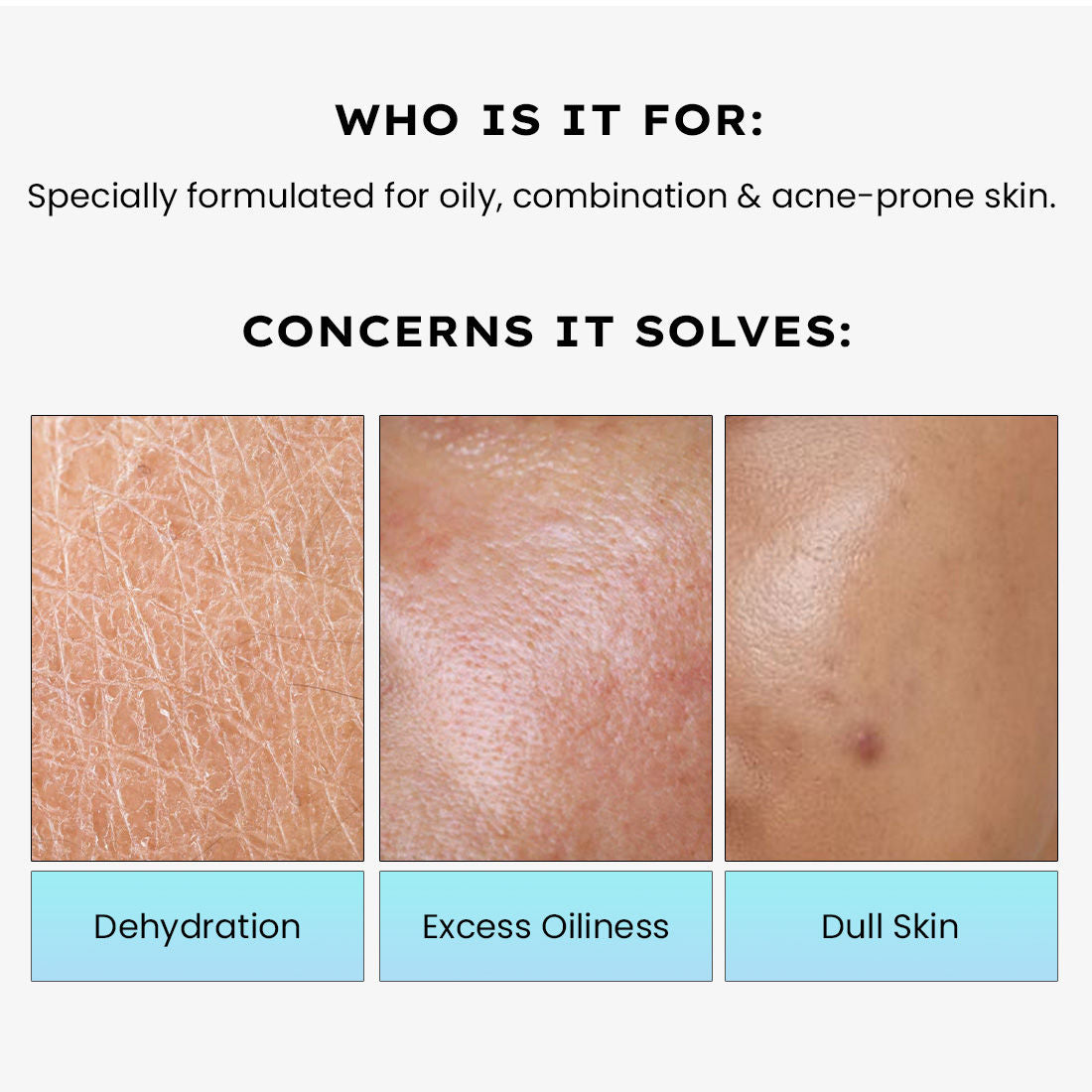 2% Cica Exosome Oil-Free Moisturizer 5% Niacinamide Controls Oil Non-sticky, Light Gel