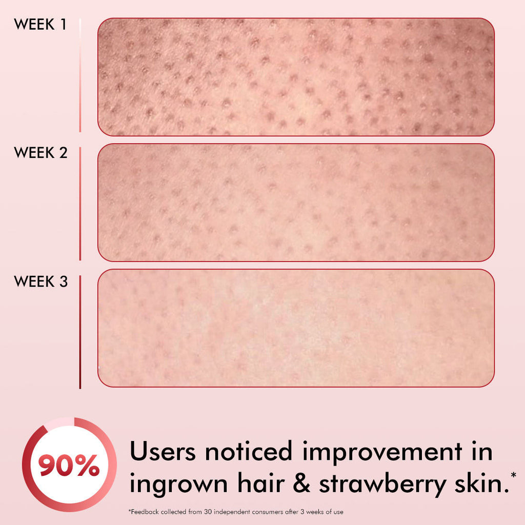 11% AHA BHA Strawberry Body Lotion for Smooth Skin, Gently Exfoliates, 72H Moisturization