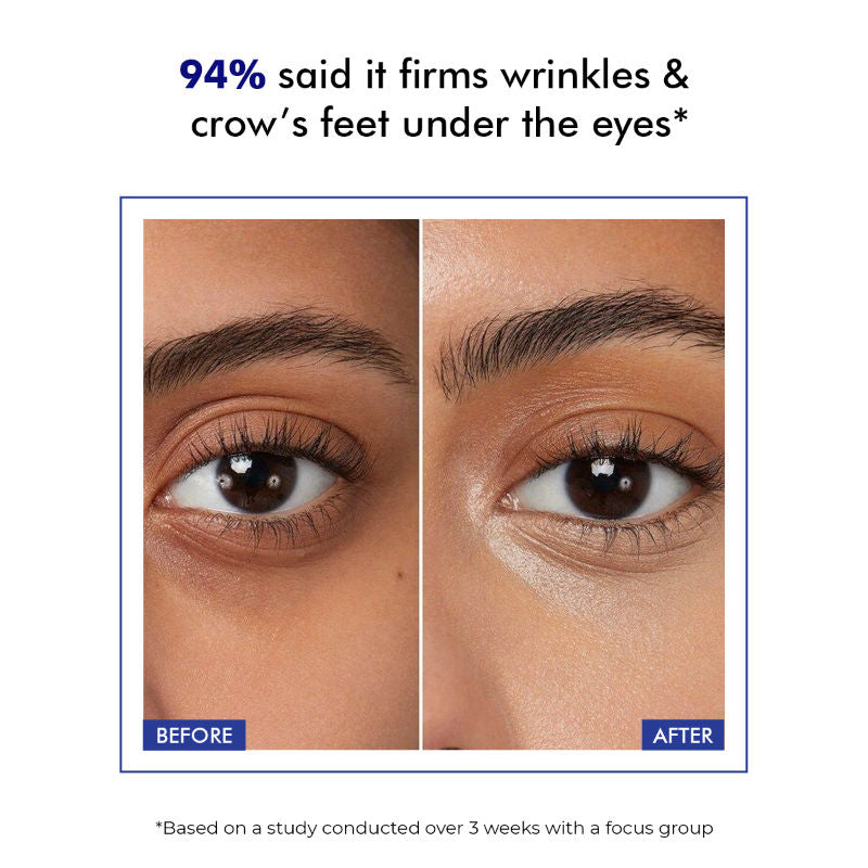 Retinol Peptide Under Eye Contour Treatment Serum For Dark Circles & Puffines