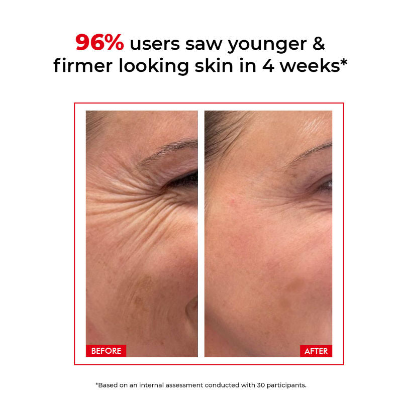 6 Peptide Complex Collagen Boosting