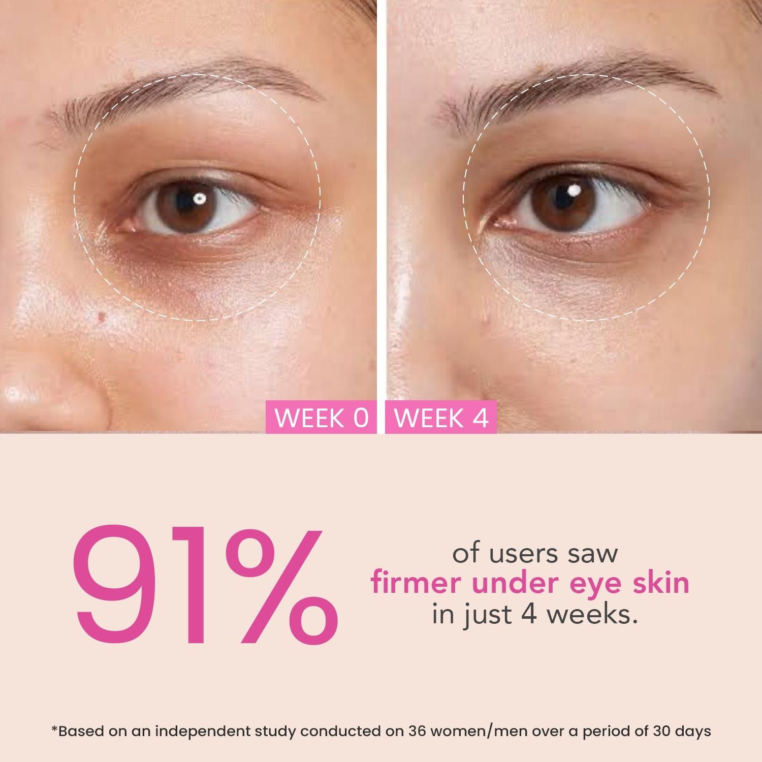 Eye Circle Brightening & Whitening Under Eye Cream